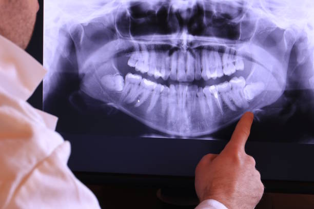 Best Teeth Whitening  in Stinnett, TX